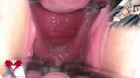 The hole expander stretches the mistress' pussy wide. Enjoy the juicy cunt meat!